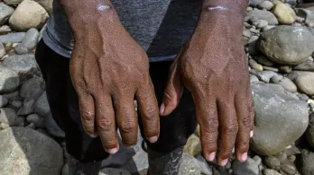 Denuncian torturas y bombardeos ilegales en Ecuador.