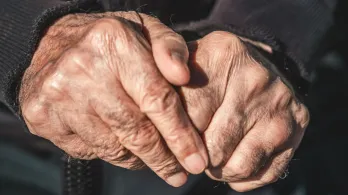 Primer trasplante de células madre para tratar el Parkinson