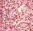 ¿Qué es el hantavirus? El virus poco común que encendió alertas tras tres muertes en un crucero