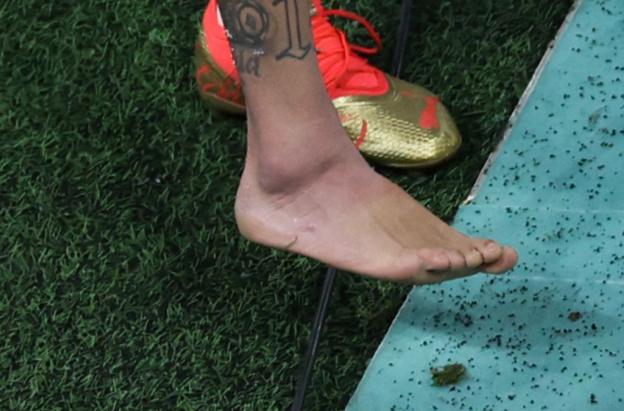 ¿Que-lesion-sufrio-Neymar-Peligra-su-participacion-en-Qatar-2022.jpg