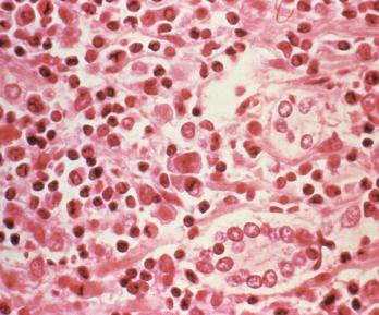 ¿Qué es el hantavirus? El virus poco común que encendió alertas tras tres muertes en un crucero