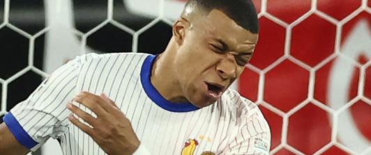 Kylian Mbappé con la nariz rota