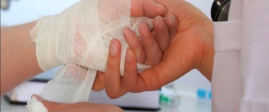 Personas quemadas por pólvora. / Foto: Gobernación del Quindío.