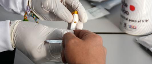 MinSalud afirma que el país no registra aumento de infecciones por VIH y la detección temprana mejora 