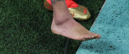 ¿Que-lesion-sufrio-Neymar-Peligra-su-participacion-en-Qatar-2022.jpg