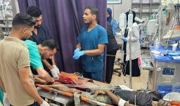Los médicos operan la pierna herida de un paciente que se encuentra en la sala de traumatología del Complejo Médico Nasser en Khan Yunis, en el sur de Gaza.