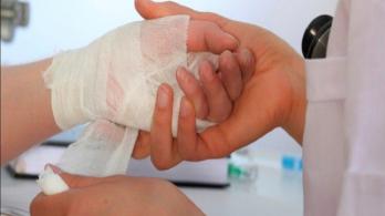 Personas quemadas por pólvora. / Foto: Gobernación del Quindío.