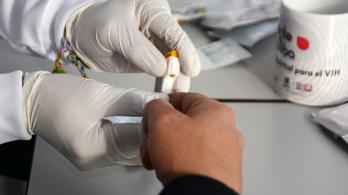 MinSalud afirma que el país no registra aumento de infecciones por VIH y la detección temprana mejora 