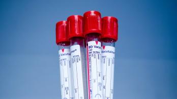 Donar-sangre.jpg