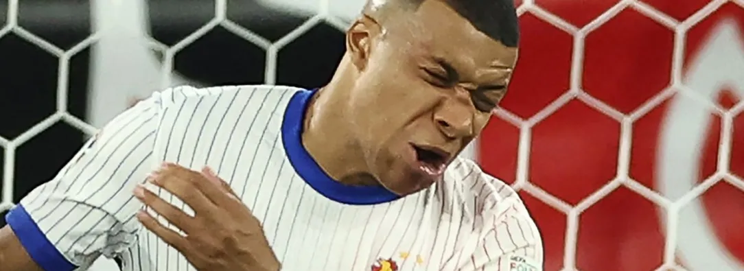 Kylian Mbappé con la nariz rota