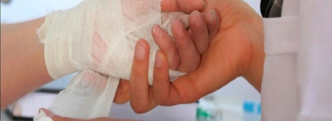 Personas quemadas por pólvora. / Foto: Gobernación del Quindío.