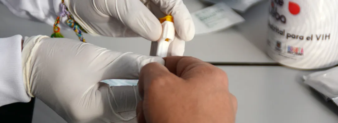 MinSalud afirma que el país no registra aumento de infecciones por VIH y la detección temprana mejora 