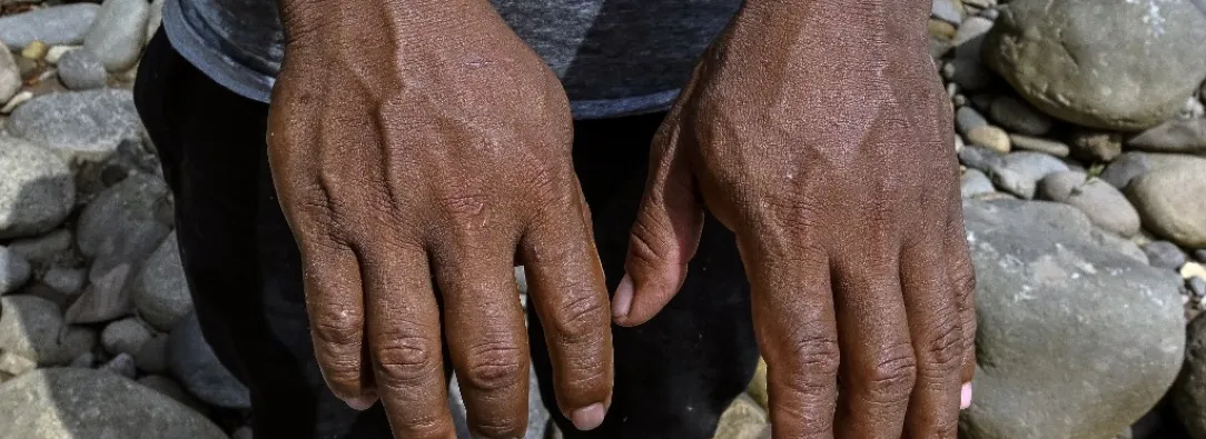 Denuncian torturas y bombardeos ilegales en Ecuador.