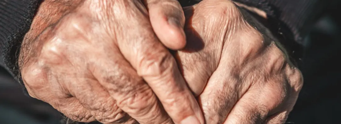 Primer trasplante de células madre para tratar el Parkinson