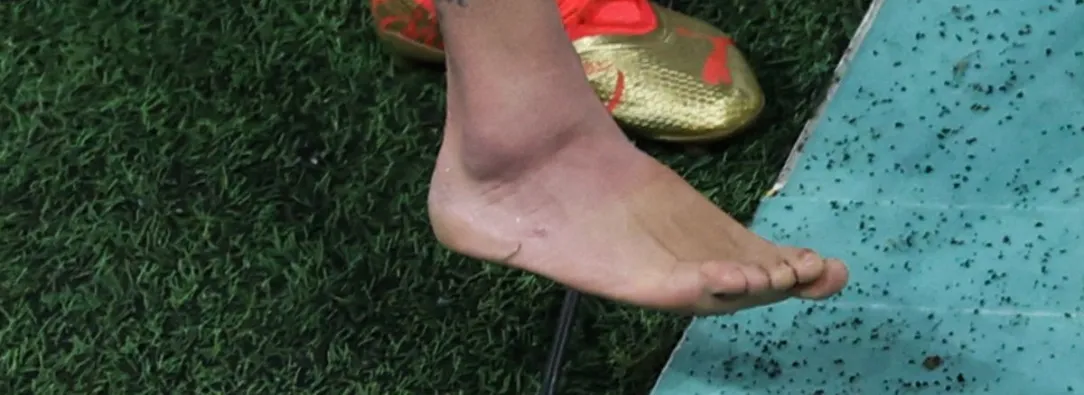 ¿Que-lesion-sufrio-Neymar-Peligra-su-participacion-en-Qatar-2022.jpg