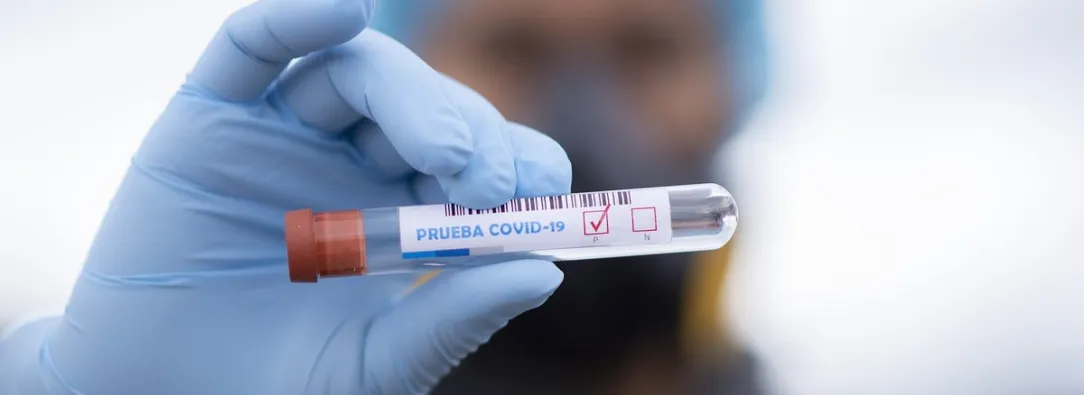 covid_19_prueba.jpg