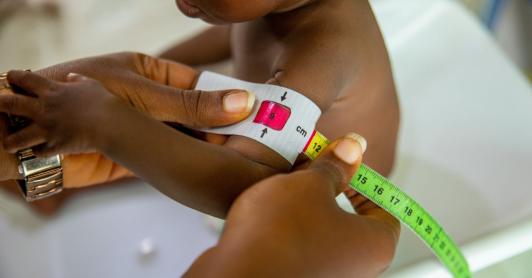 "Bajamos la mortalidad por desnutrición infantil en 55%", presidente Petro