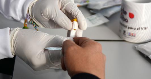 MinSalud afirma que el país no registra aumento de infecciones por VIH y la detección temprana mejora 